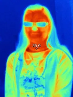 IR000079